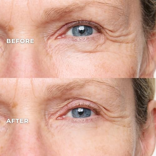 WUNDER2 Wunderlift Instant Eye Tightening Serum, Temporary Firming & Lifting Treatment in 60 Seconds, Reduces Under-Eye Bags, Dark Circles, Puffiness