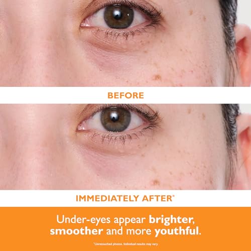 Peter Thomas Roth | Potent-C™ Power Brightening Hydra-Gel Eye Patches | Eye Mask Patches for Under-Eye Bags and Fine Lines | Brightens The Look of
