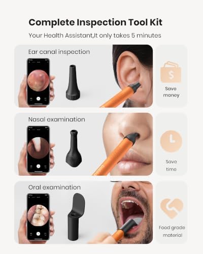 BEBIRD R1 Ear Wax Removal Tool:Ear Cleaner with HD Ear Camera FSA&HSA