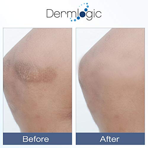 Vitamin K Cream- Moisturizing Bruise Healing Formula. Dark Spot Corrector for Bruising