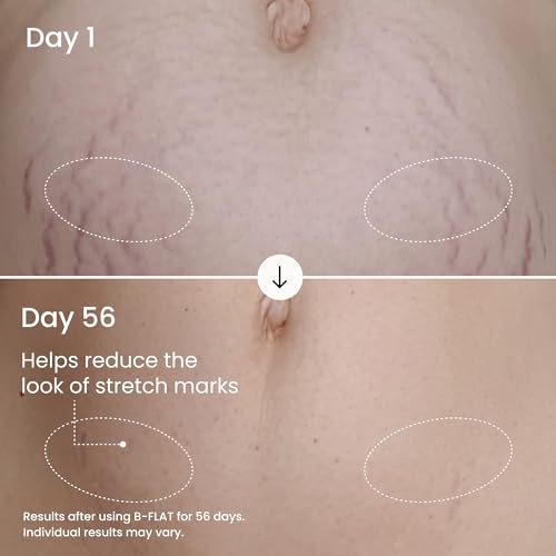 MAËLYS B-FLAT Belly Firming Cream for Women, 3.4 Fl Oz