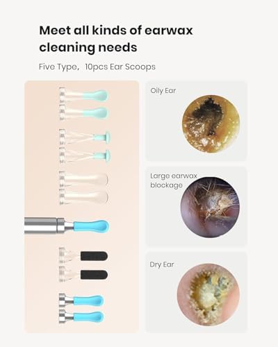BEBIRD R1 Ear Wax Removal Tool:Ear Cleaner with HD Ear Camera FSA&HSA