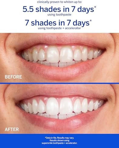 Supersmile Awake Zesty Mint Whitening Toothpaste, with Caffeine, 4.2 Oz