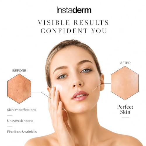 Glycolic Acid 15% Anti-Aging AHA Wrinkle Cream – Reduces the Appearance of Fine Lines, Wrinkles, Age Spots & Dark Spots – Exfoliates, Smooths