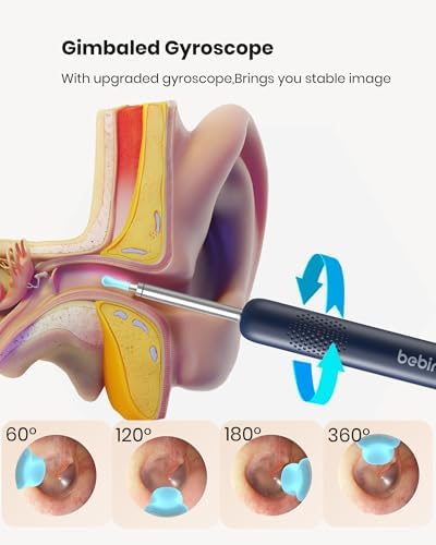 BEBIRD R1 Ear Wax Removal Tool:Ear Cleaner with HD Ear Camera FSA&HSA