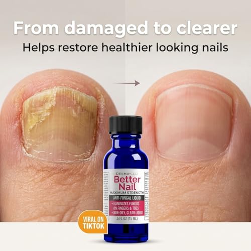 Better Nail - Treatment for Fungus Under & Around the Nail - Maximum Strength, 25% Anti Fungal Solution for Nail Support, Nail Restoring