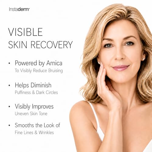 Vitamin K Cream-Revitalizing Formula with Arnica for the Appearance of Brusing, Spider Veins, Broken Capillaries
