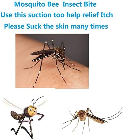 2PK Mosquito Bee Sting Bug Bite Kit Suction Tool Safety Supplies Natural First Aid for Hiking Backpacking Camping