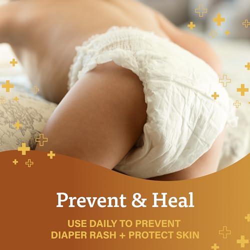 A+D Original Diaper Rash Ointment Prevents & Treats Diaper Rash, Moisturizing Skin Protectant with Vitamins A & D