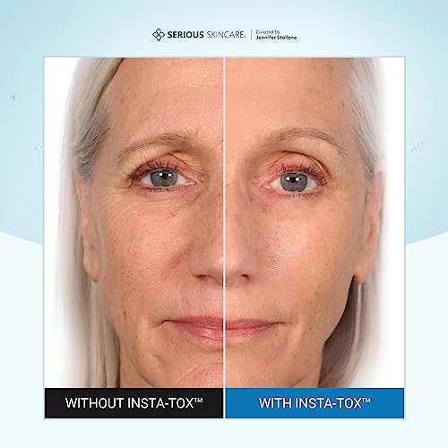 Serious Skincare INSTA-TOX Instant Wrinkle Filler for Face Serum, to Smooth + Blur Fine Lines, Deep Wrinkles, Lip Lines, Crow’s Feet & Pores, Temporary Face Tightener, for Smoother Skin .75 oz