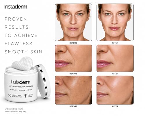 Anti-Aging Resurfacing Pads – Smooth’s Fine Lines, Wrinkles, Dark Spots, Freckles