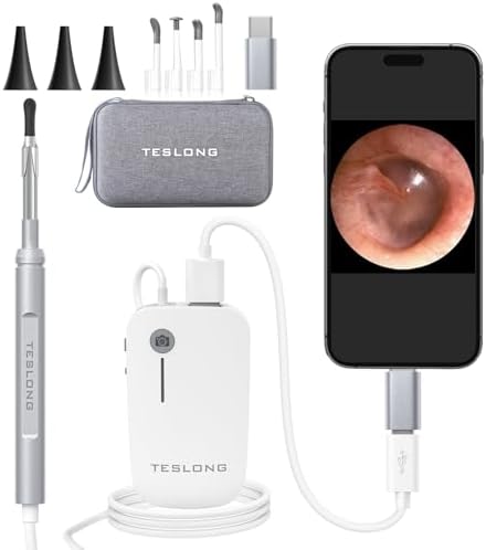 Digital Otoscope with Light 1080P Full HD Otoscope Camera for USB-C Devices | 4.3mm Lens, 6 LED Lights, Waterproof Ear Camera for Ear Viewing