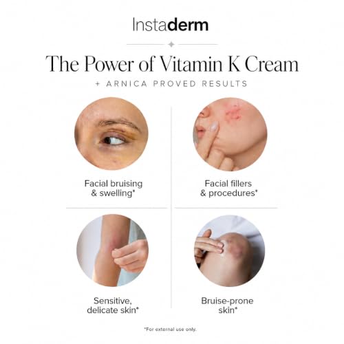 Vitamin K Cream-Revitalizing Formula with Arnica for the Appearance of Brusing, Spider Veins, Broken Capillaries