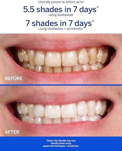 Supersmile Original Mint Whitening Toothpaste, 1.4 Oz, TSA Travel | Calprox® + Fluoride Travel Toothpaste, Whitens 3 Shades After 1 Day, Signature Wild Mint Flavor, Veneer Safe, RDA 65