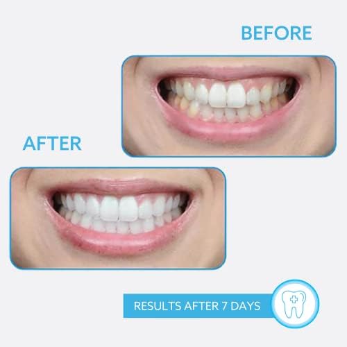 GO SMILE Professional Clean Luxury Whitening Toothpaste, large 3.4oz tube, Enriched with Vitamins A, C & E, Mint Flavor eliminates bad breath, Removes Stains, Dentist Recommended, Made in the USA