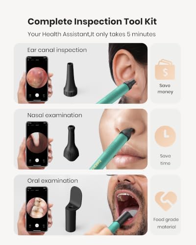 BEBIRD R1 Ear Wax Removal Tool:Ear Cleaner with HD Ear Camera FSA&HSA