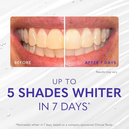 Smileactives Teeth Whitening Kit with Gel & Pen, Hydrogen Peroxide, 30-Day