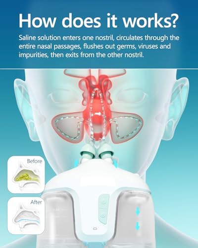 Sonmol Nasal Irrigation System with 50 Salt Packets for Congestion Relief | 2 Modes Sinus Rinse Machine, Self-Cleaning Nose Cleaner for Adult