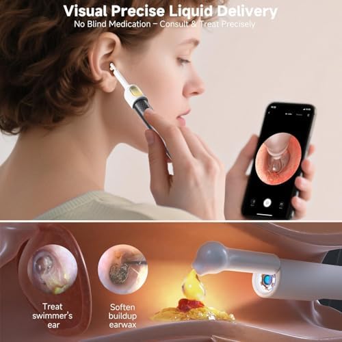 BEBIRD R1 Ultra Ear Wax Removal Tweezers:1296P HD Ear Camera Cleaner, Black