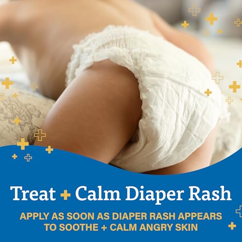 A+D Zinc Oxide Diaper Rash Treatment Cream, Dimethicone 1%, Zinc Oxide 10%, Easy Spreading Baby Rash Cream, 4 Ounce Tube (Packaging May Vary)