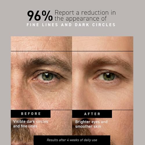 Brickell Men's Restoring Under Eye Cream for Men, Anti Aging Eye Balm To Reduce Puffiness, Wrinkles, Dark Circles, Crows Feet & Eye Bags, Caffeine