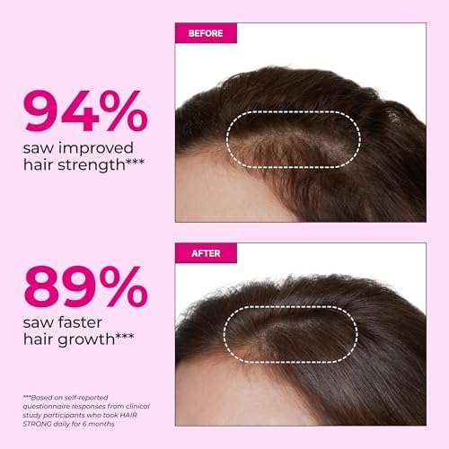 HUM Hair Strong Strawberry Gummies, Hair Growth Support, 60 Count | Folic Acid, Fo-Ti Root Extract, Biotin, Zinc & B12, Vegan Strawberry Gummies, Women & Men