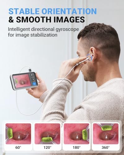 ScopeAround Otoscope with 4.5" IPS Screen, 3.9mm Ear Camera with Gyroscope