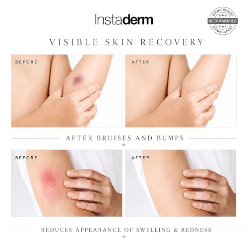 Vitamin K Cream-Revitalizing Formula with Arnica for the Appearance of Brusing, Spider Veins, Broken Capillaries