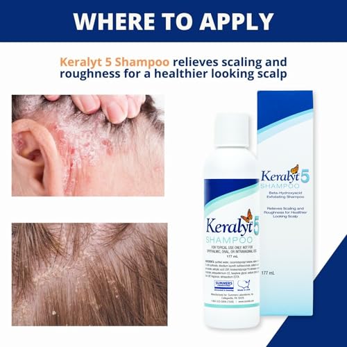 5 Anti-Dandruff Shampoo - Max Strength 5% Salicylic Acid Scalp Build-Up Clearing - Promotes Relief from Dandruff, Psoriasis, Seborrheic Dermatitis, Dryness, and Itchiness, 177 milliliters