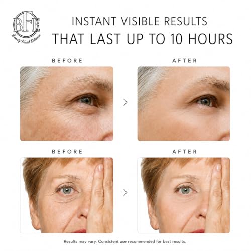 Instant Eye Tightener Cream - Instantly Reduces Under Eye Puffiness, Bags
