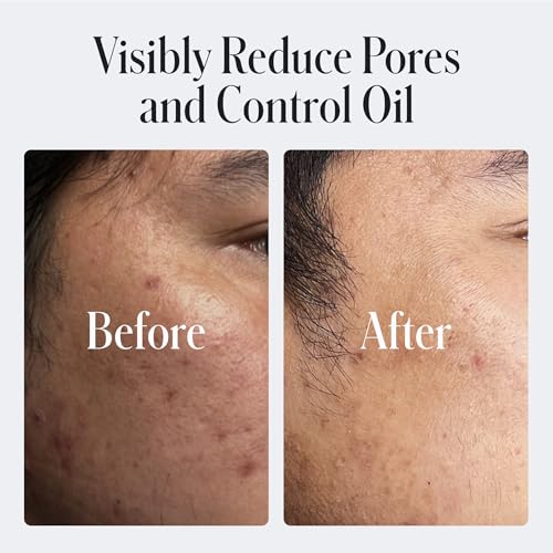 Geologie Daily Face Wash for Sensitive Skin | Fragrance-Free Facial Cleanser for Men & Women | Acne & Oil Control | Non-irritating