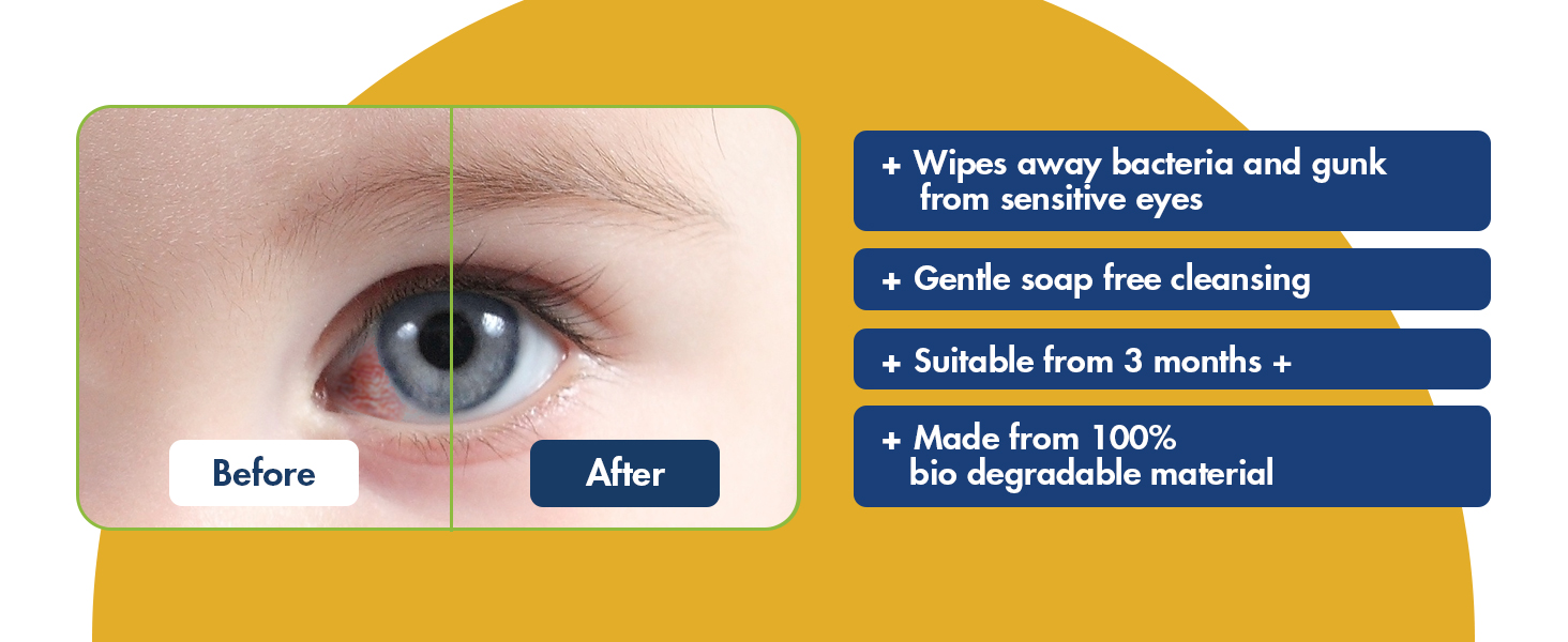 baby wipes