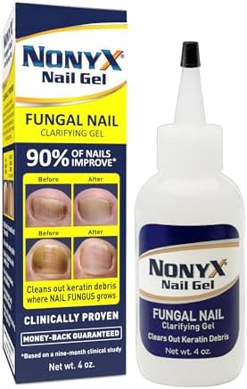 NONYX Fungal Nail Clarifying Gel | Clinically Proven for Discolored, Thick, Brittle, Yellow, Lifted