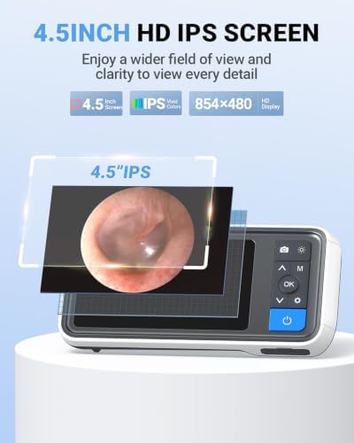 ScopeAround Otoscope with 4.5" IPS Screen, 3.9mm Ear Camera with Gyroscope