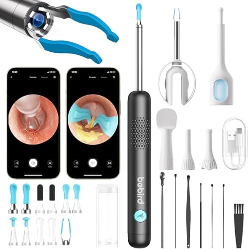 BEBIRD R1 Ultra Ear Wax Removal Tweezers:1296P HD Ear Camera Cleaner, Black