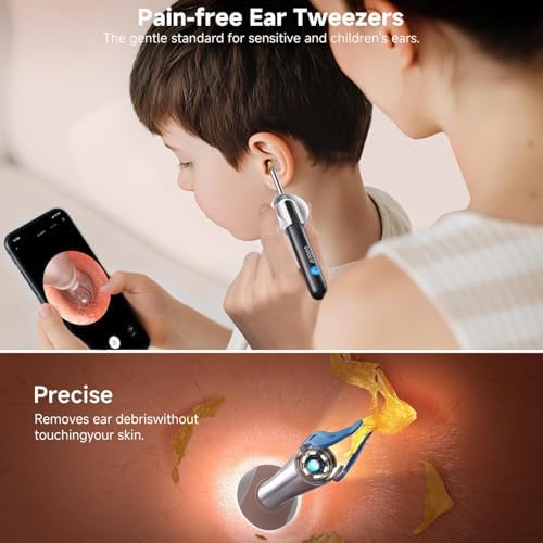 BEBIRD R1 Ultra Ear Wax Removal Tweezers:1296P HD Ear Camera Cleaner, Black