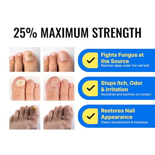 Approved Science Fungix Extra Strength - Undecylenic Acid and Tea Tree Oil - Serum for Fingernail and Toenail Care - Infused with Essential Oils - Healthy Nail Appearance - Easy to Apply - Pack of 1