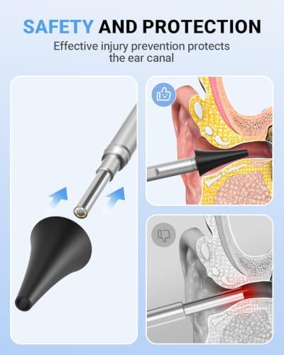 ScopeAround Otoscope with 4.5" IPS Screen, 3.9mm Ear Camera with Gyroscope