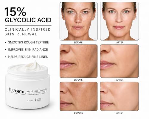 Glycolic Acid 15% Anti-Aging AHA Wrinkle Cream – Reduces the Appearance of Fine Lines, Wrinkles, Age Spots & Dark Spots – Exfoliates, Smooths