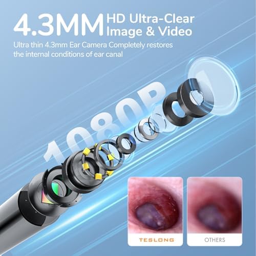 Digital Otoscope with Light 1080P Full HD Otoscope Camera for USB-C Devices | 4.3mm Lens, 6 LED Lights, Waterproof Ear Camera for Ear Viewing
