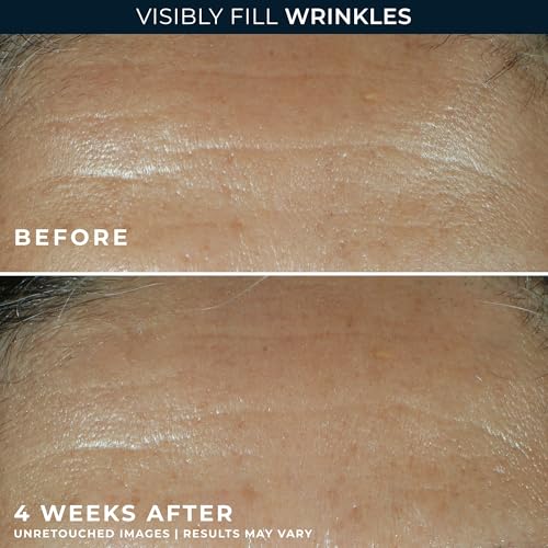 RoC Retinol Correxion Wrinkle Filler for Deep Wrinkles with Hyaluronic Acid | 1oz retinol serum for face, skin care for women and men, visibly reduce fine lines, clinically proven, packaging may vary