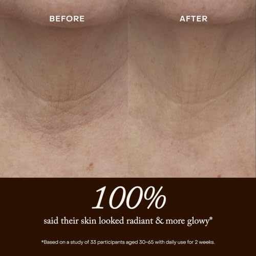 True Botanicals Pure Radiance Body Oil | Anti-Aging Body Oil for All Skin Types | Moisturize & Restore Skin Health | Dermatologist Tested, All Natural