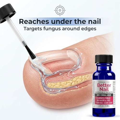 Better Nail - Treatment for Fungus Under & Around the Nail - Maximum Strength, 25% Anti Fungal Solution for Nail Support, Nail Restoring