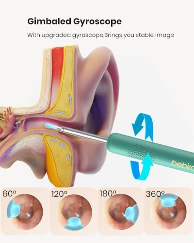 BEBIRD R1 Ear Wax Removal Tool:Ear Cleaner with HD Ear Camera FSA&HSA