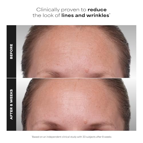 Paula's Choice CLINICAL 1% Retinol Face Treatment with Peptides | Anti-Aging Face Serum with Vitamin C & Licorice Extract for Fine Lines & Wrinkles, Fragrance Free