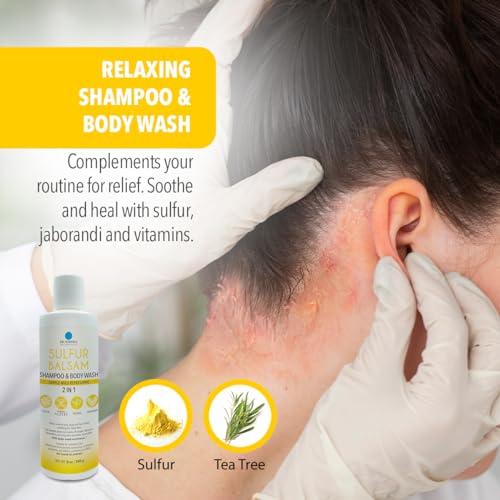 Dr. Robaina Sulfur Shampoo & Body Wash – Helps Soothe Dandruff, Seborrheic Dermatitis, Folliculitis & Itchy Scalp – Color-Safe, SLS-Free, Citrus-Mint Scent, 8 fl oz - Made in the USA