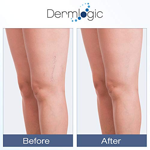 Vitamin K Cream- Moisturizing Bruise Healing Formula. Dark Spot Corrector for Bruising