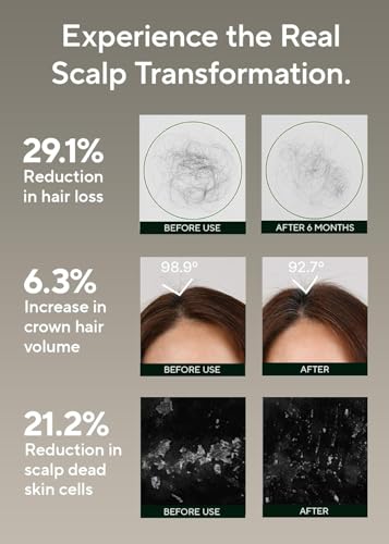 AROMATICA Rosemary Scalp Scaling Shampoo for Hair Growth | Korean Hair Care for Thinning Hair & Hair Loss, Natural Essential Oil, Vegan, Sulfate Silicone Paraben Free (13.53 oz)