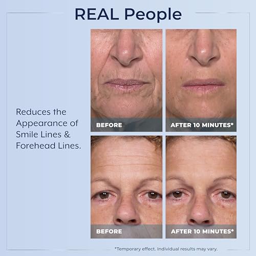 Plexaderm Eye Serum, 30 Single Use Pods - Visibly Reduces Bags & Wrinkles
