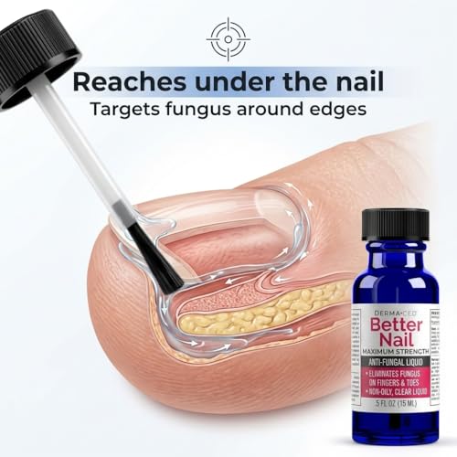 Better Nail - Treatment for Fungus Under & Around the Nail - Maximum Strength, 25% Anti Fungal Solution for Nail Support, Nail Restoring